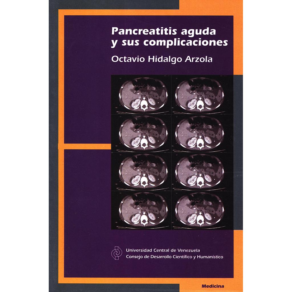 Pancreatitis aguda y sus complicaciones